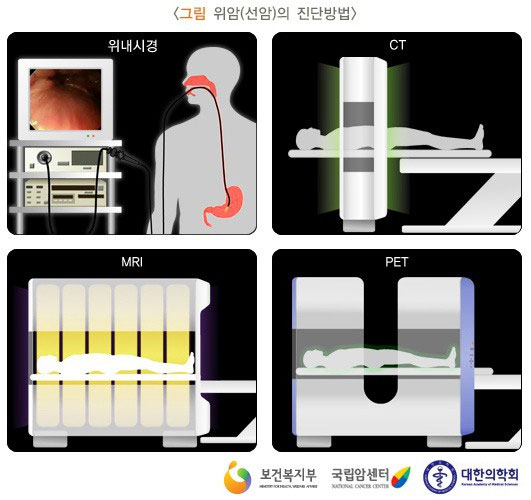 [그림: 위암(선암)의 진단방법]위내시경. CT, MRI, PET 검사이미지