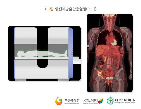 [그림: 양전자방출단층촬영(PET)] 출처: 보건복지부, 국립암센터, 대한의학회