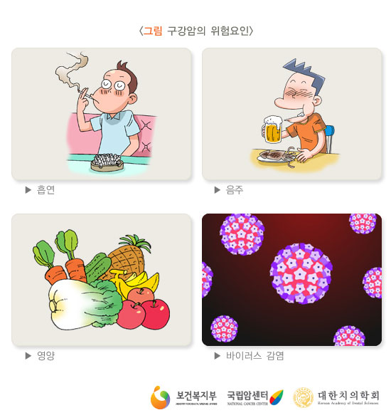 [그림: 구강암의 위험요인] 흡연, 음주, 영양,바이러스 감염(출처: 보건복지부, 국립암센터, 대한치의학회)