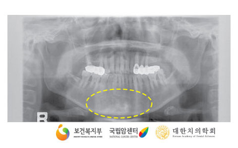 파노라마 사진(출처: 국가암정보센터)
