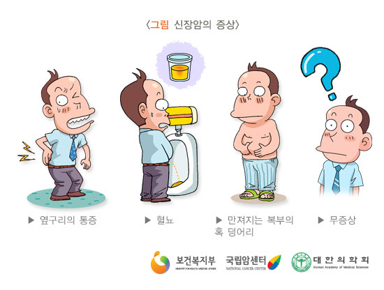 [그림:신장암의 증상] 옆구리의 통증, 혈뇨,만져지는 복부의 혹 덩어리,무증상(출처: 보건복지부, 국립암센터, 대한의학회)