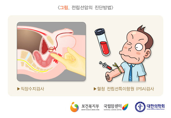 [그림: 전립선암의 진단방법]직장수지검사, 혈청 전립선특이항원 (PSA)검사