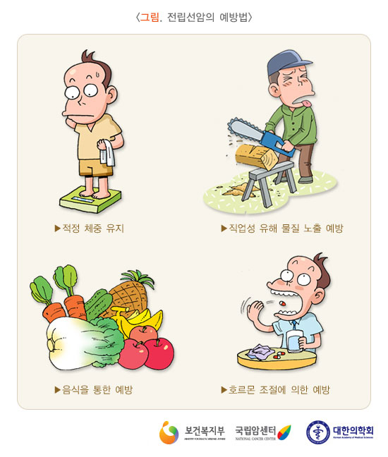 [그림:전립선암의 예방법]적정체중유지,직업성 유해 물질 노출 예방,음식을 통한 예방,호르몬 조절에 의한 예방