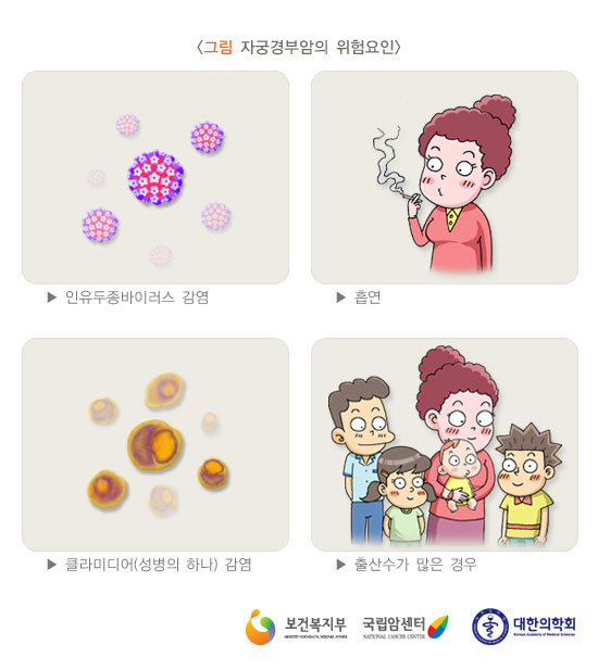 [그림: 자궁경부암의 위험요인] 인유두종바이러스 감염, 흡연, 클라미디어(성병의 하나) 감염, 출산수가 많은 경우(출처: 보건복지부, 국립암센터, 대한의학회)