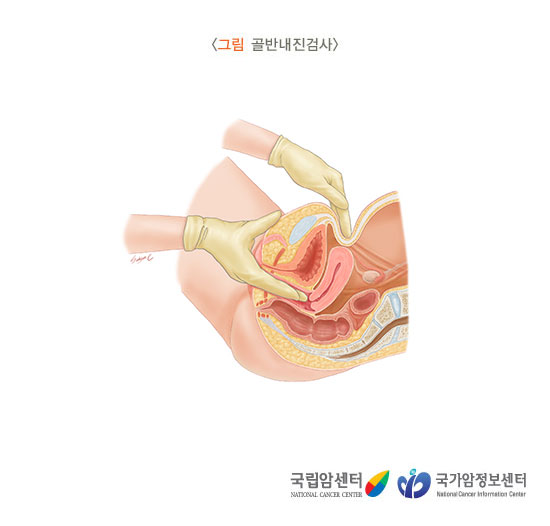 출처: 국립암센터, 국가암정보센터