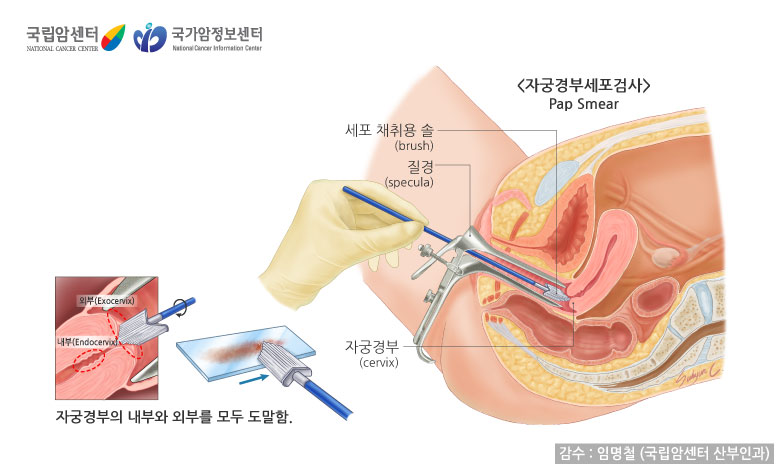출처: 국립암센터, 국가암정보센터