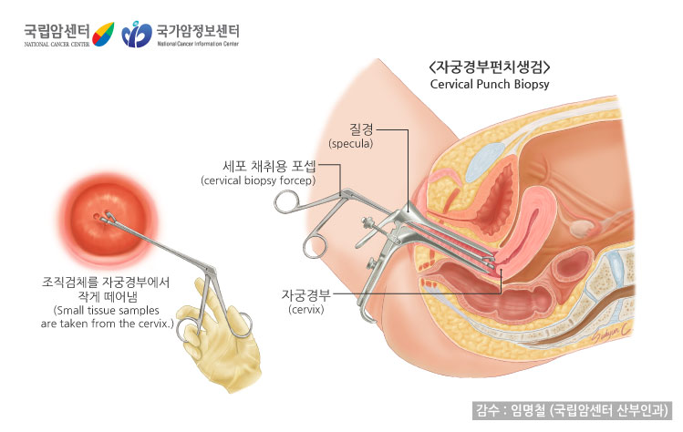 출처: 국립암센터, 국가암정보센터