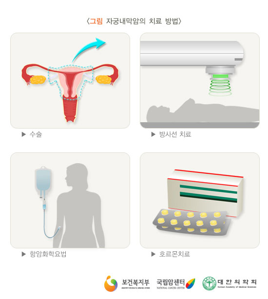 [그림: 자궁내막암의 치료방법] 수술, 방사선치료, 항암화학요법, 호르몬치료(출처: 보건복지부, 국립암센터, 대한의학회)