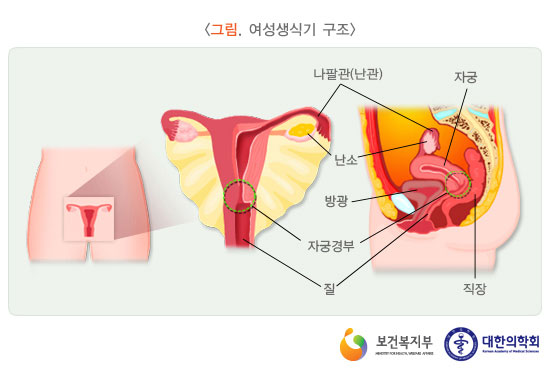[그림: 여성생식기 구조] 나팔관, 난소, 방광, 자궁경부, 질, 직장, 자궁 등의 부위(출처: 보건복지부, 대한의학회)