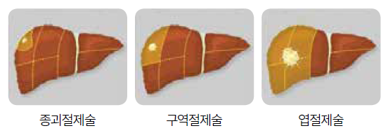 editor20220608142449.png