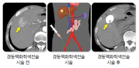 editor20220608142548.png
