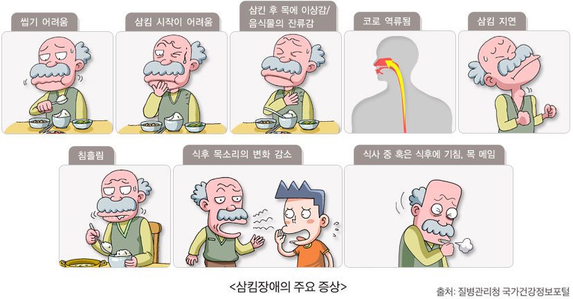 삼킴장애의 주요 증상