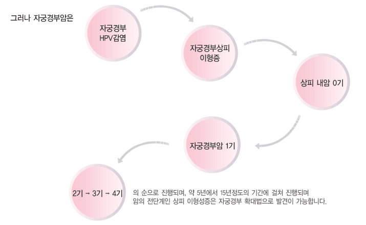 그러나 자궁경부암은 자궁경부 HPV감염→자궁경부상피 이형증→상피내암 0기→자궁경부암 1기→2기→3기→4기의 순으로 진행되며, 약 5년에서 15년 정도의 기간에 걸쳐 진행되며 암의 전단계인 상피 이형성증은 자궁경부확대법으로 발견이 가능하다.