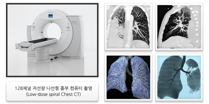 128채널 저선량 나선형 흉부 컴퓨터 촬영 (Low-dose spiral Chest CT)